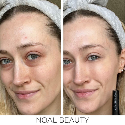noal-beauty-creme-concealer-contour-makeup-stick-alex-before-after